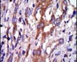 Aurora A Antibody in Immunohistochemistry (IHC)