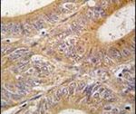 Aurora A Antibody in Immunohistochemistry (IHC)