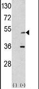Aurora A Antibody in Western Blot (WB)