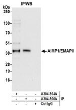 AIMP1/EMAPII/SCYE1 Antibody in Immunoprecipitation (IP)