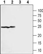 Sigma-1 Receptor Antibody in Western Blot (WB)