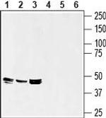 Septin-7 Antibody in Western Blot (WB)