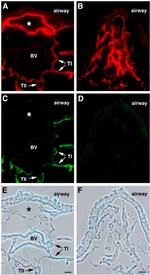 GFP Antibody in Immunohistochemistry (Frozen), Immunocytochemistry (IHC (F), ICC/IF)