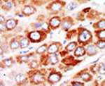 Adenylate Kinase 1 Antibody in Immunohistochemistry (IHC)
