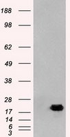 AK1 Antibody in Western Blot (WB)
