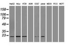 AK1 Antibody in Western Blot (WB)