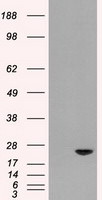 AK1 Antibody in Western Blot (WB)