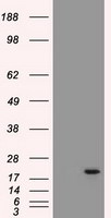AK1 Antibody in Western Blot (WB)