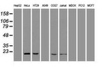 AK1 Antibody in Western Blot (WB)