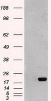 AK1 Antibody in Western Blot (WB)