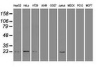 AK1 Antibody in Western Blot (WB)