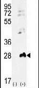 Adenylate Kinase 1 Antibody in Western Blot (WB)