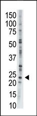 Adenylate Kinase 1 Antibody in Western Blot (WB)