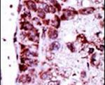 Adenylate Kinase 2 Antibody in Immunohistochemistry (IHC)