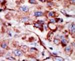 Adenylate Kinase 2 Antibody in Immunohistochemistry (IHC)