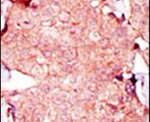 Adenylate Kinase 3 Antibody in Immunohistochemistry (IHC)