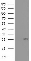 AK3 Antibody in Western Blot (WB)