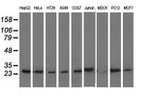 AK3 Antibody in Western Blot (WB)