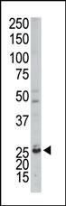 Adenylate Kinase 3 Antibody in Western Blot (WB)