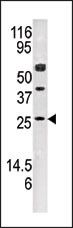 Adenylate Kinase 3 Antibody in Western Blot (WB)