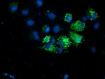 AK4 Antibody in Immunocytochemistry (ICC/IF)