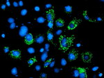 AK4 Antibody in Immunocytochemistry (ICC/IF)