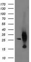 AK4 Antibody in Western Blot (WB)
