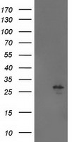 AK4 Antibody in Western Blot (WB)