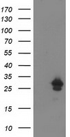 AK4 Antibody in Western Blot (WB)