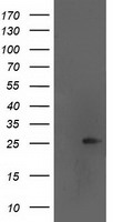 AK4 Antibody in Western Blot (WB)