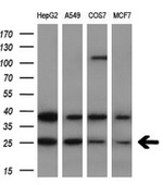 AK4 Antibody in Western Blot (WB)