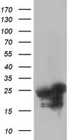 AK4 Antibody in Western Blot (WB)