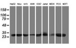 AK4 Antibody in Western Blot (WB)