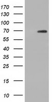 AK5 Antibody in Western Blot (WB)