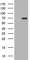 AK5 Antibody in Western Blot (WB)