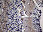 AKAP12 Antibody in Immunohistochemistry (Paraffin) (IHC (P))