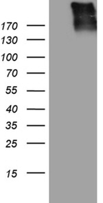 AKAP12 Antibody in Western Blot (WB)