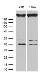 AKAP12 Antibody in Western Blot (WB)
