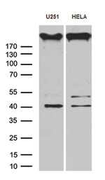 AKAP12 Antibody in Western Blot (WB)