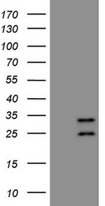 AKIP1 Antibody in Western Blot (WB)