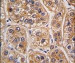 AKR1A1 Antibody in Immunohistochemistry (IHC)