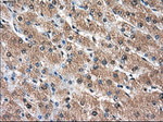 AKR1A1 Antibody in Immunohistochemistry (Paraffin) (IHC (P))