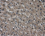 AKR1A1 Antibody in Immunohistochemistry (Paraffin) (IHC (P))