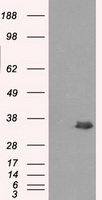 AKR1A1 Antibody in Western Blot (WB)
