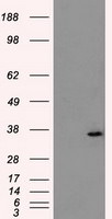 AKR1A1 Antibody in Western Blot (WB)