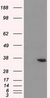 AKR1A1 Antibody in Western Blot (WB)
