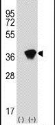 AKR1A1 Antibody in Western Blot (WB)