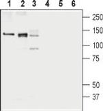 KCC1 (SLC12A4) Polyclonal Antibody