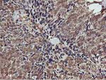 AKT1 Antibody in Immunohistochemistry (Paraffin) (IHC (P))