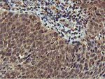 AKT1 Antibody in Immunohistochemistry (Paraffin) (IHC (P))